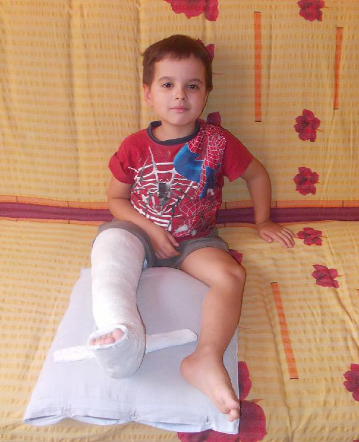 Boala „oaselor de sticlă”: când joaca înseamnă durere