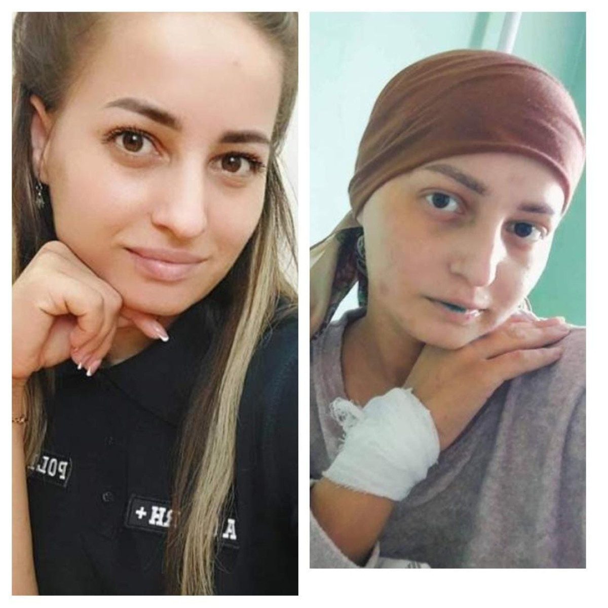 Donează 2 EURO prin SMS. Alexandrina suferă de CANCER!