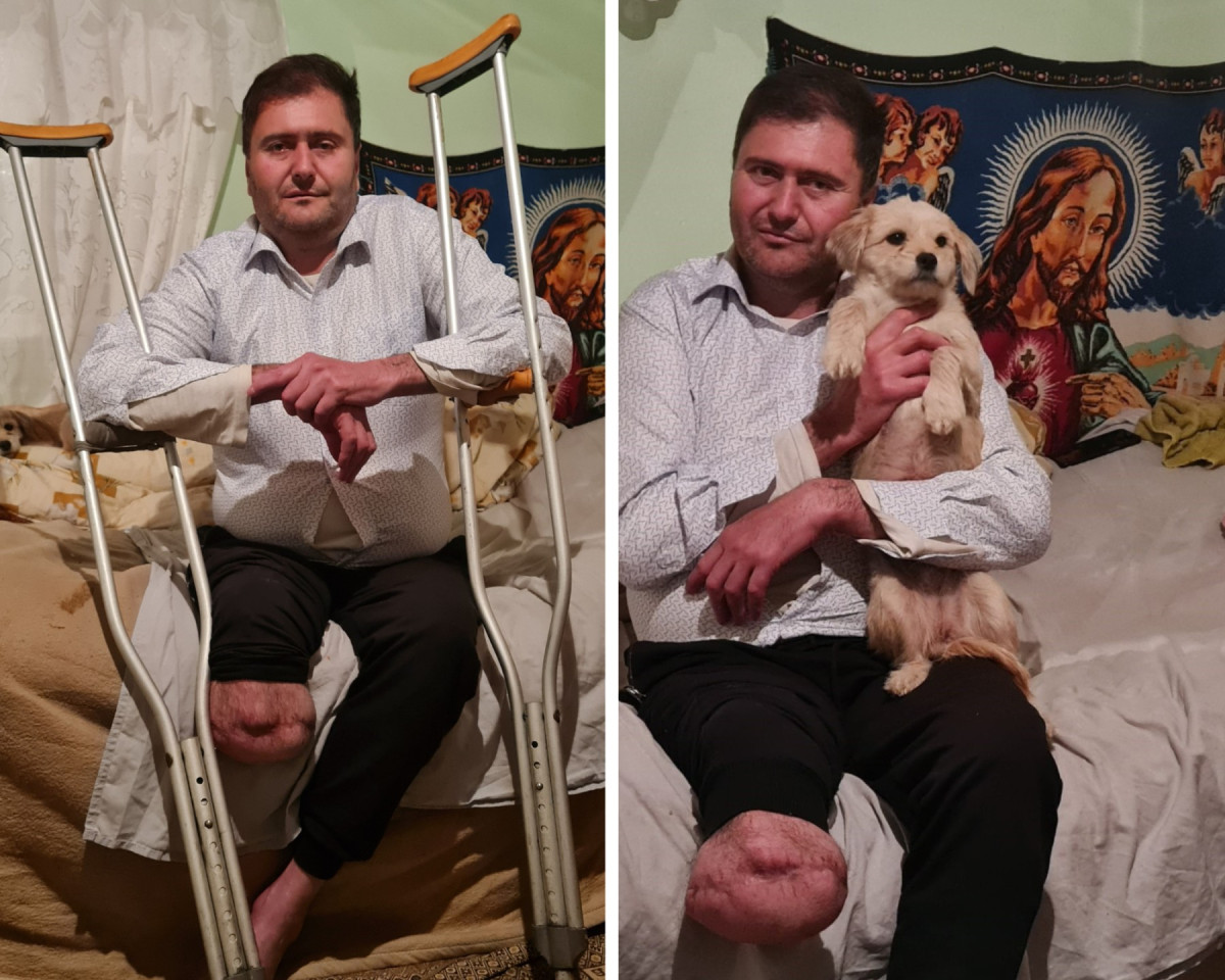 Ion are piciorul amputat, o pensie de 64 de lei și are mare nevoie de proteză!
